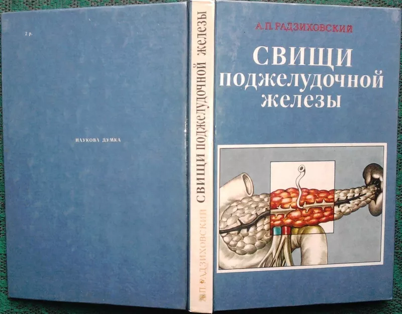  Свищи поджелудочной железы  монография . А. П. Радзиховский.   